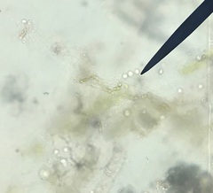 Methanococcus