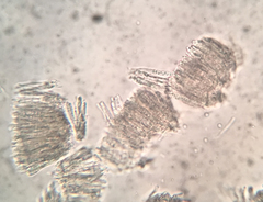 Hyphodiscus theiodeus