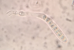 Hyphodiscus theiodeus