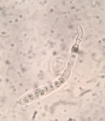 Hyphodiscus theiodeus