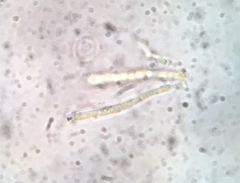 Hyphodiscus theiodeus