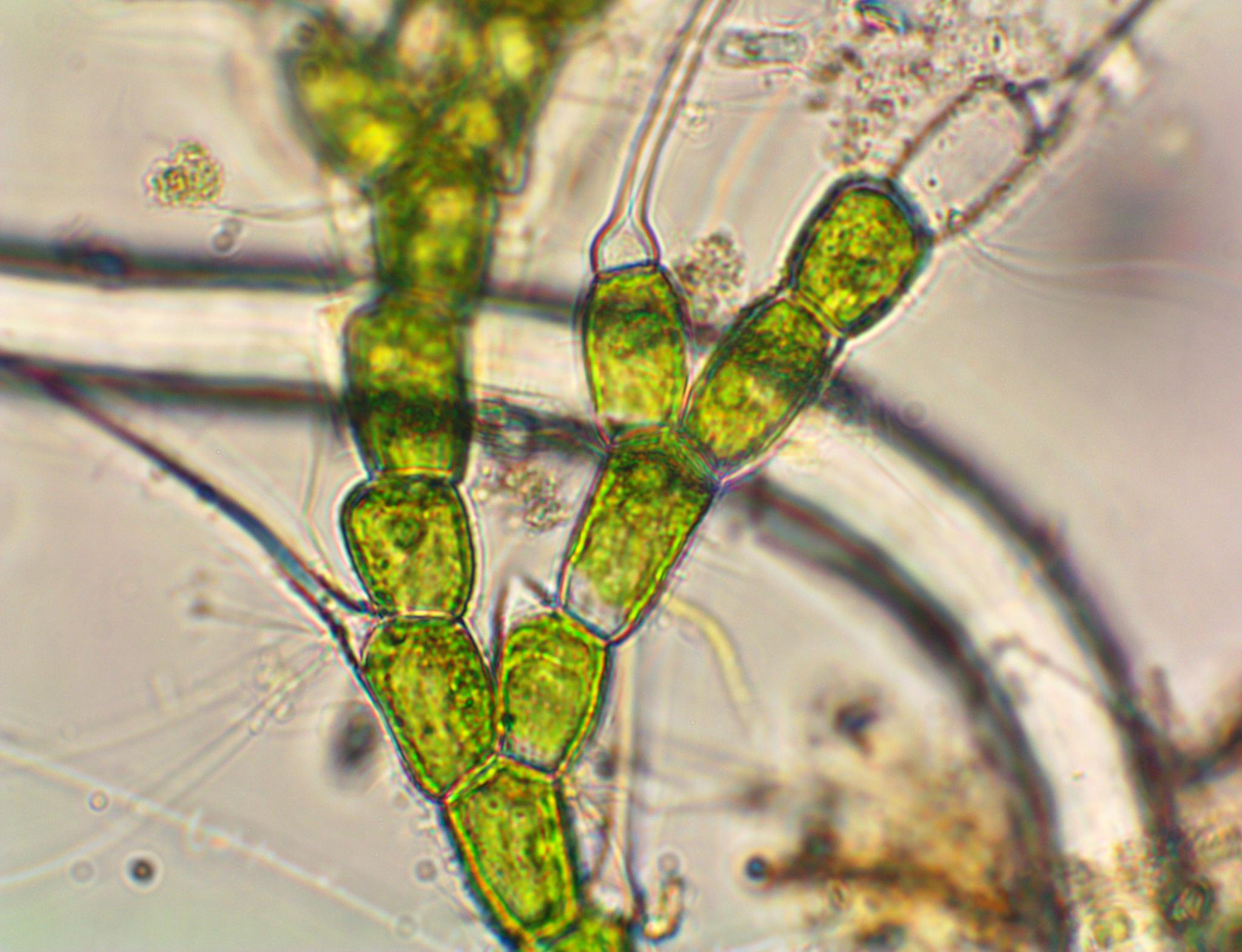 Bulbochaete