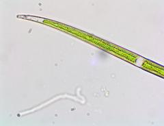 Closterium gracile
