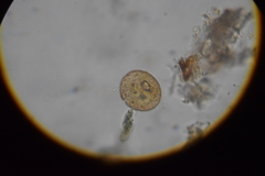 Arcella hemisphaerica