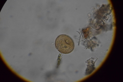 Arcella hemisphaerica