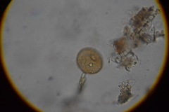 Arcella hemisphaerica