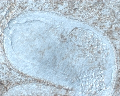 Bothromesostoma personatum