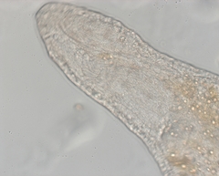 Stenostomum
