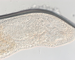 Stenostomum