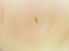 Insecta