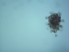 Dolichospermum lemmermannii