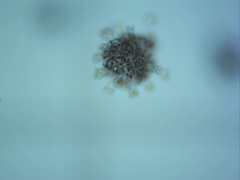 Dolichospermum lemmermannii