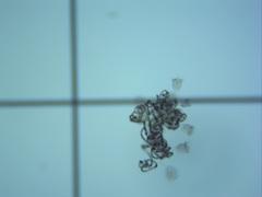 Dolichospermum lemmermannii