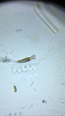 Bdelloidea