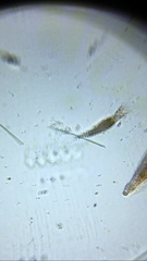 Bdelloidea