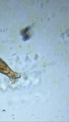 Bdelloidea