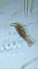 Bdelloidea