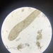 Spirostomum ambiguum - Photo (c) iamtunafish12, algunos derechos reservados (CC BY-NC), subido por iamtunafish12