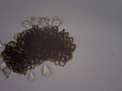 Dolichospermum lemmermannii