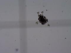 Dolichospermum lemmermannii