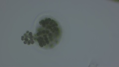 Microcystis wesenbergii