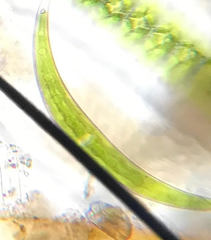 Closterium moniliferum