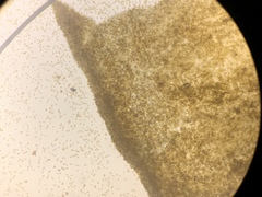 Cortinarius verrucisporus