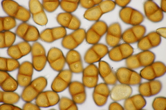 Puccinia echinopis