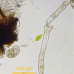 Chlorogonium