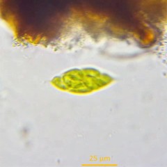 Chlorogonium