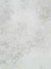 Saccharomyces cerevisiae