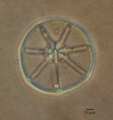 Asteromphalus heptactis