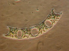 Eucampia zodiacus