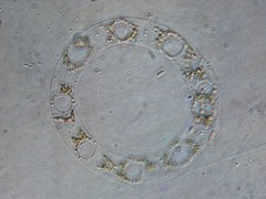 Eucampia zodiacus