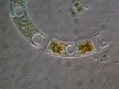Eucampia zodiacus