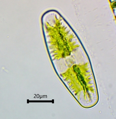 Netrium digitus