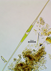 Closterium setaceum