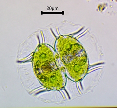 Xanthidium antilopaeum