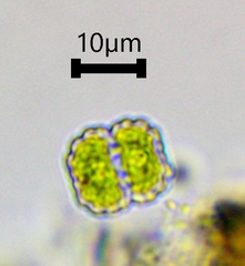 Cosmarium blyttii