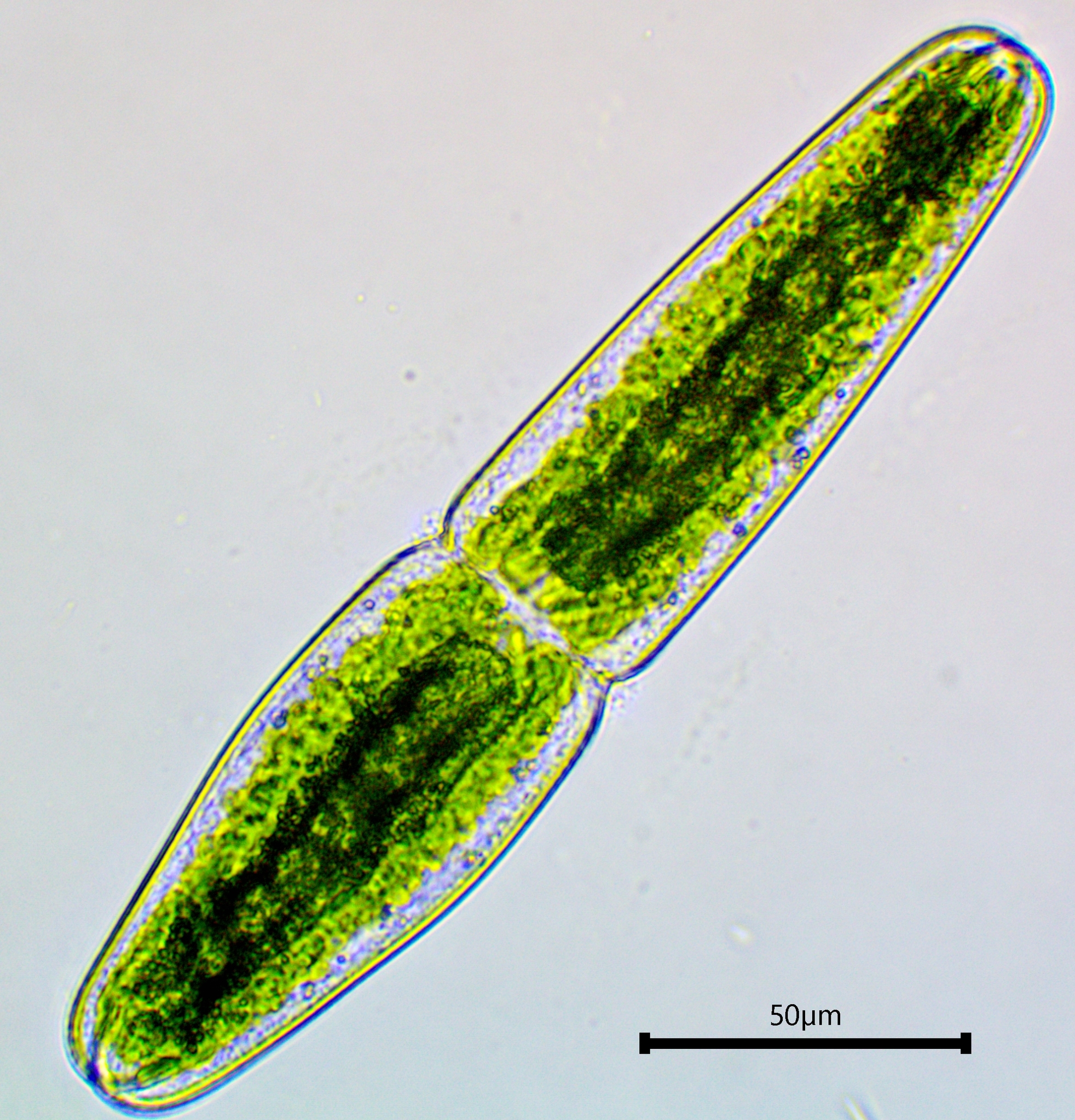 Tetmemorus granulatus