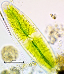 Netrium digitus