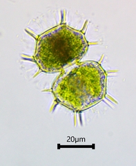 Xanthidium cristatum