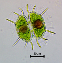 Xanthidium antilopaeum