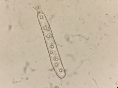 Hydnotrya variiformis