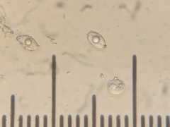 Hydnotrya variiformis