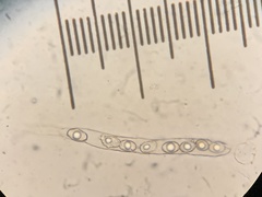 Hydnotrya variiformis