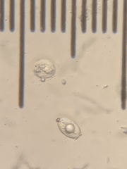 Hydnotrya variiformis