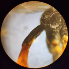 Tryphoninae