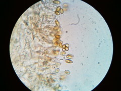 Galerina stordalii