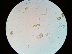 Galerina stordalii